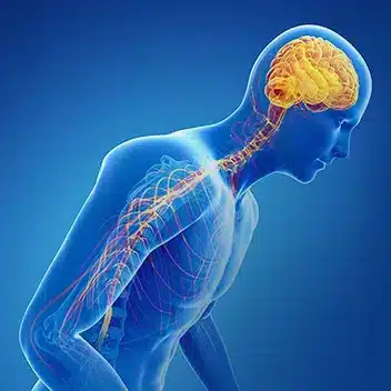 درمان پارکینسون در طب اسلامی درمان پارکینسون در طب اسلامی